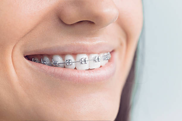Best Veneers and Lumineers  in Sylvania, AL
